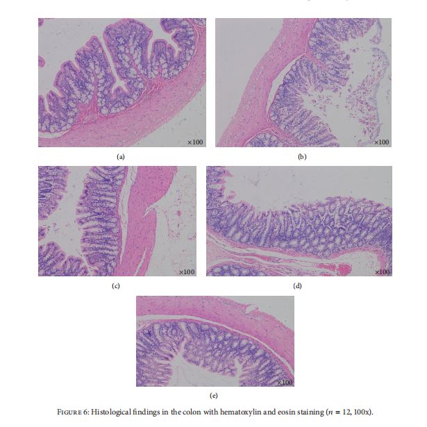  Histological findings in the colon with hematoxylin and eosin staining (𝑛 = 12, 100x).